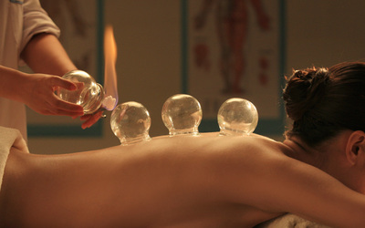 Cupping Therapy